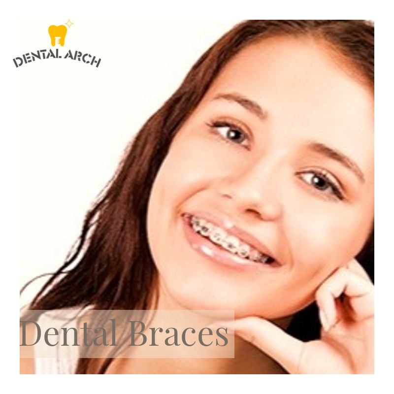 Orthodontic braces treatment