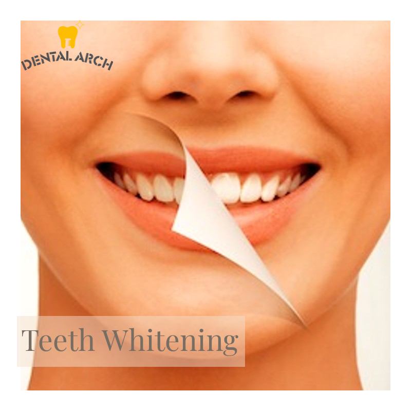 Cosmetic dentistry and smile makeover